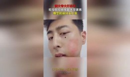 大爷打架吃瓜视频,围观群众纷纷吃瓜